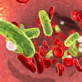Sepsis-Früherkennung wird möglich